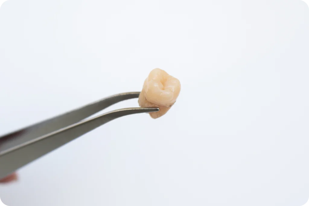 brossage rouen implant dentaire FAQ implants dentaires Dr Mehdi HALLOUL, chirurgien-dentiste à Rouen