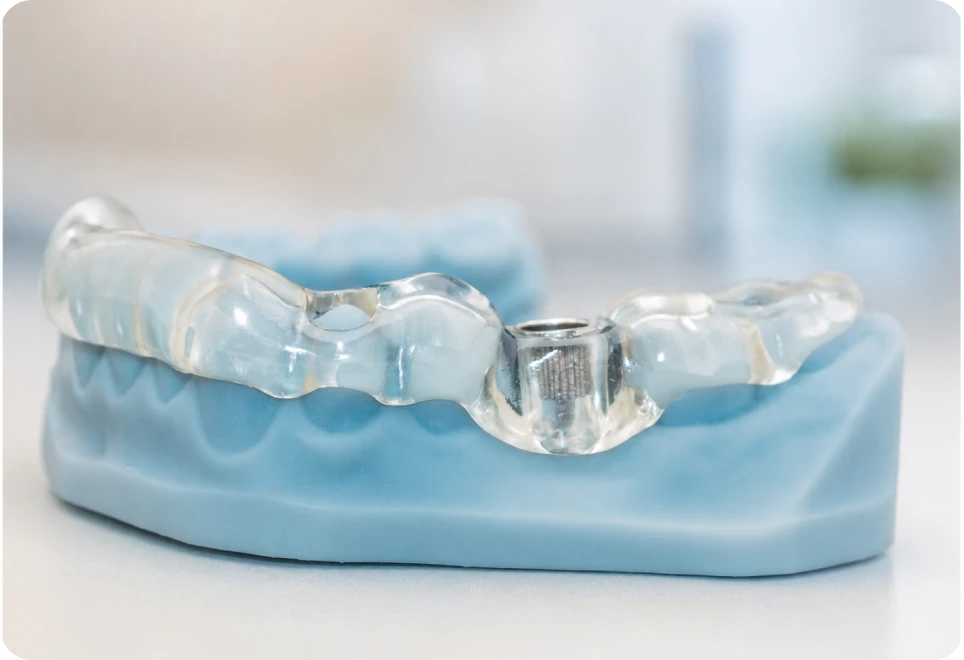 chirurgie guidee docteur halloul dentiste rouen Nos technologies Dr Mehdi HALLOUL, chirurgien-dentiste à Rouen