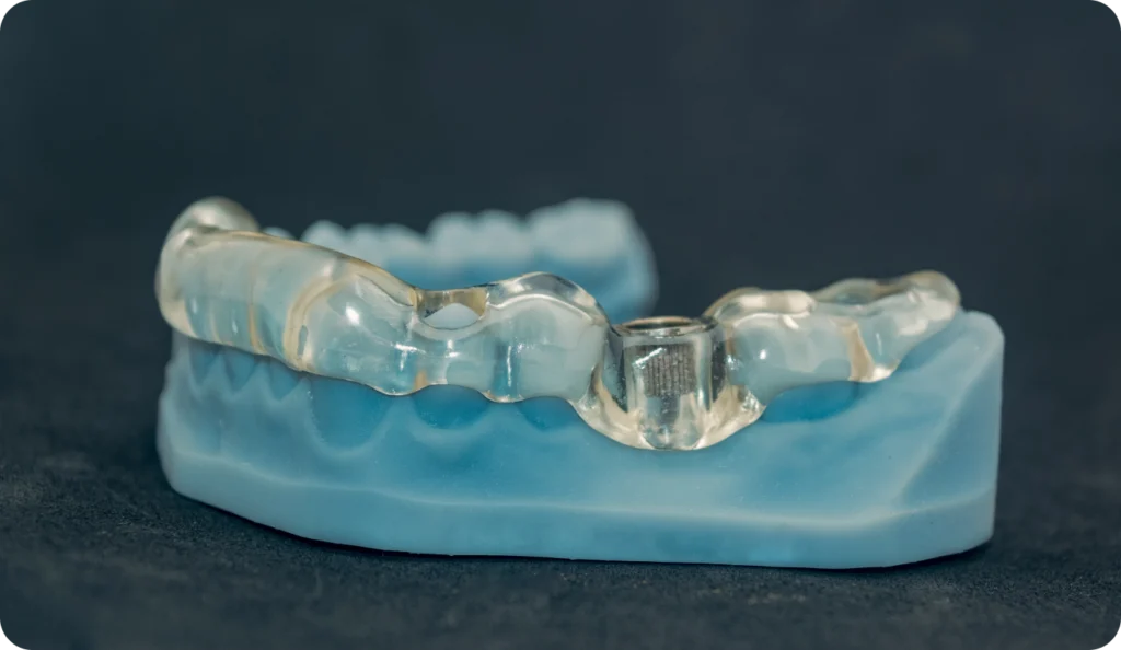 chirurgie guidee rouen Reconstructions complètes guidées Dr Mehdi HALLOUL, chirurgien-dentiste à Rouen