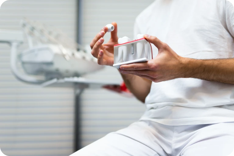 Qu&rsquo;est-ce qu&rsquo;un implant dentaire ?