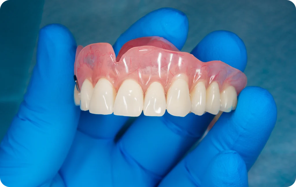 prothse rovisoire fixe roeun prothse rovisoire fixe roeun Protocoles de mise en charge immédiate Dr Mehdi HALLOUL, chirurgien-dentiste à Rouen