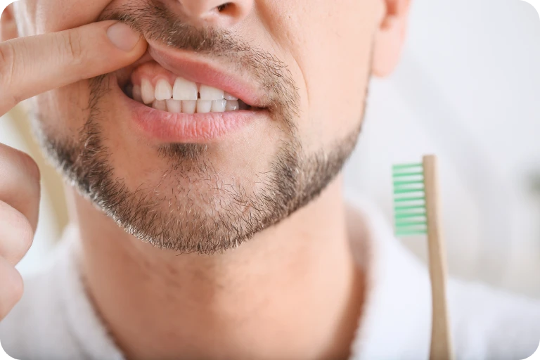 Soins des gencives : importance de l&rsquo;hygiène bucco-dentaire