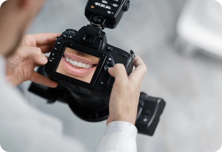 Prise de photographie clinique pour le bilan pré-chirurgical