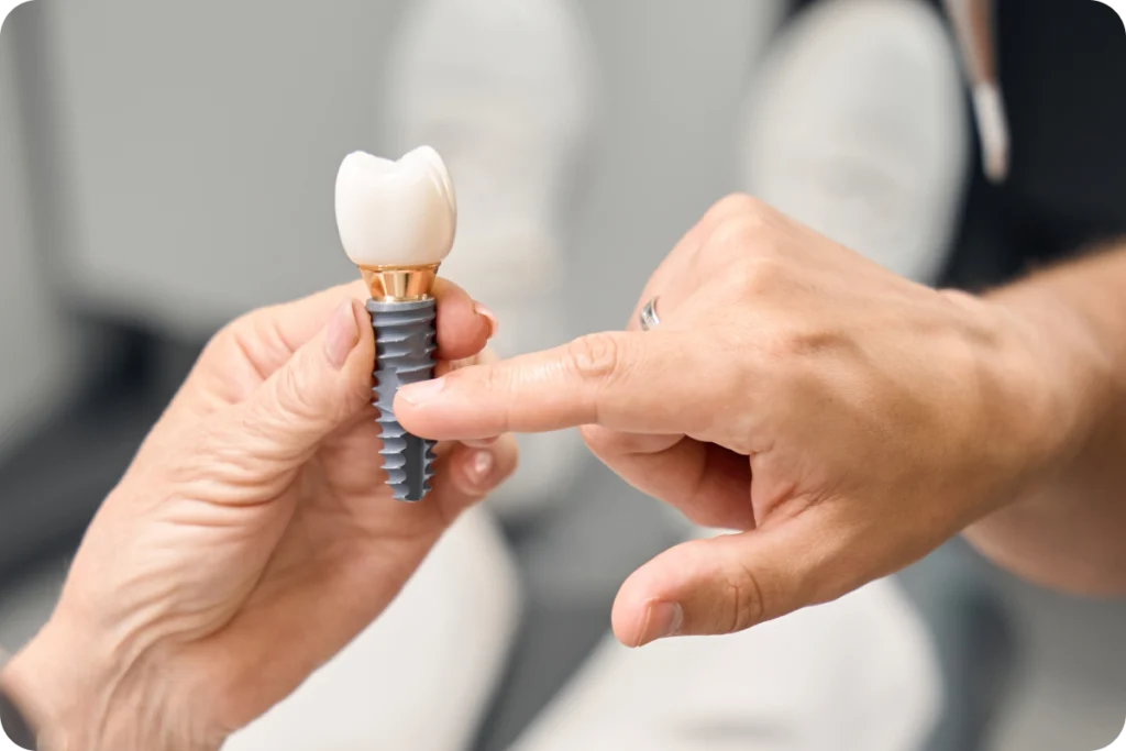 Suites opératoires après pose d&rsquo;implant dentaire